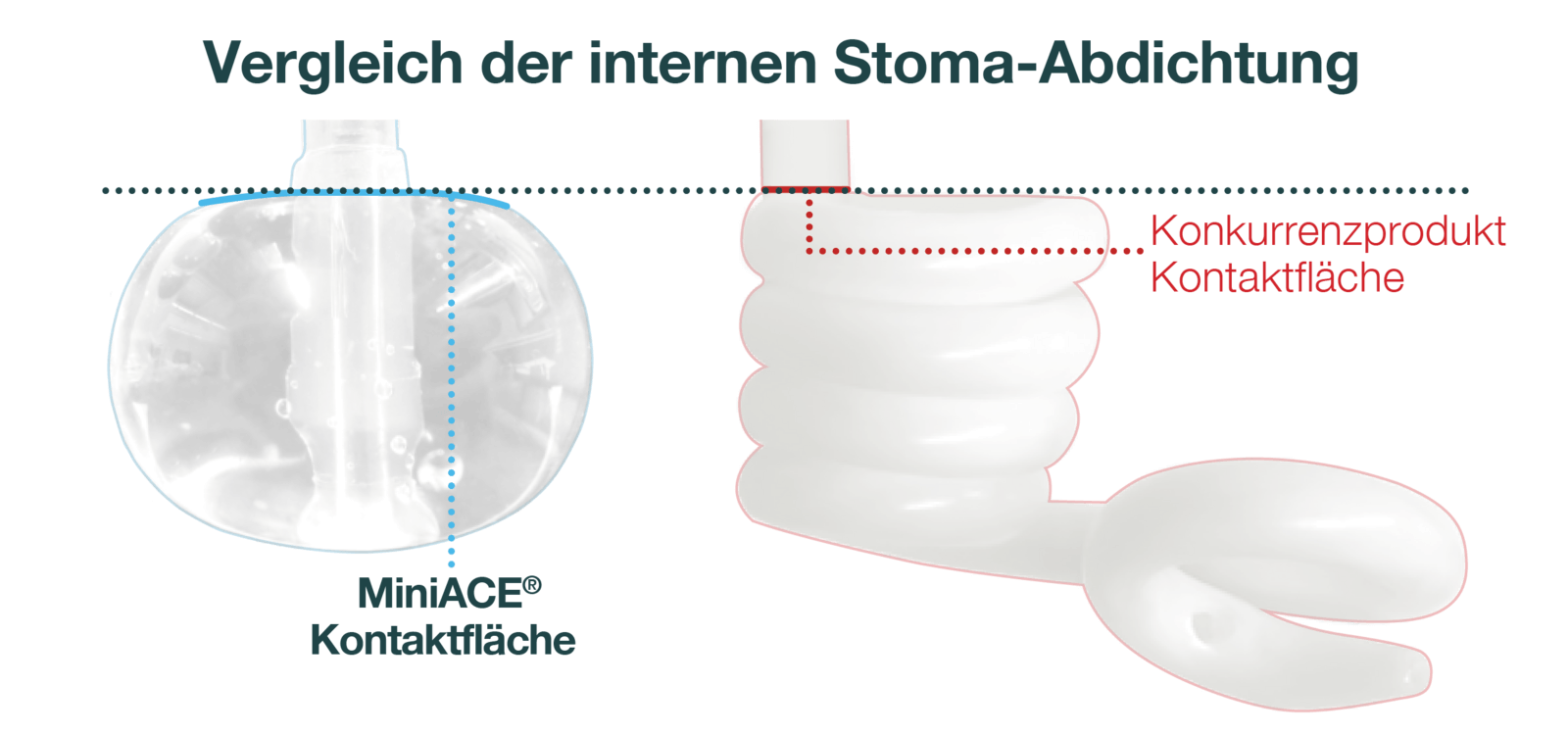 Es dreht sich alles um den Ballon