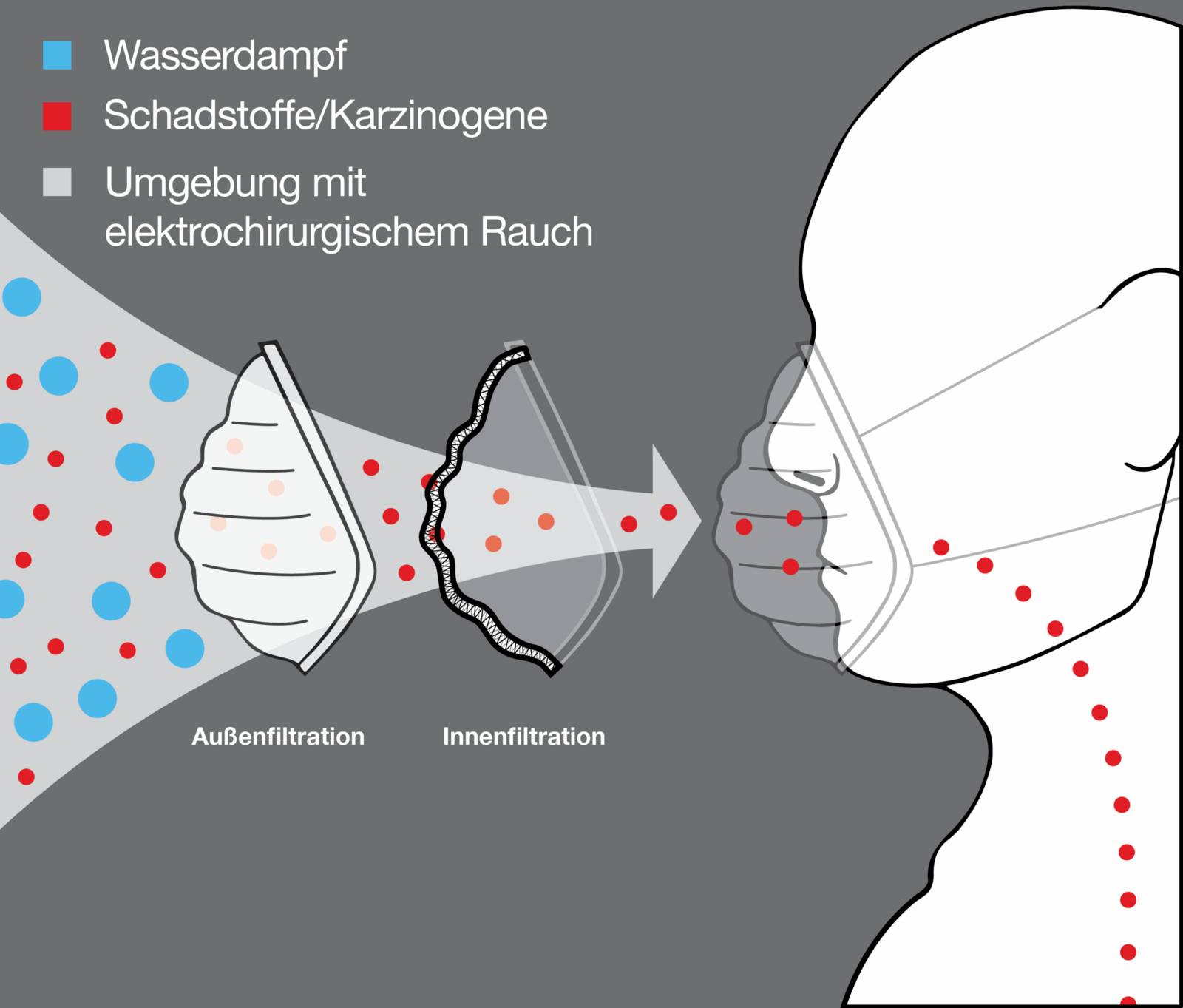Chemische Komplexität von laser- und elektrochirurgischem Rauchgas